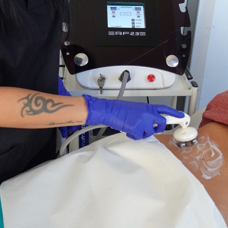 Trattamento radio frequenza 1 Come funziona MyBodyTone